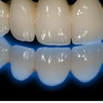 suggestiva fluorescenza