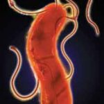 Helicobacter pylori