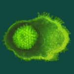 Herpes zoster