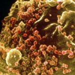 Un linfocita T infettato dal virus HIV