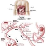 Normale processo metabolico