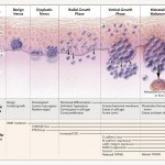 Melanoma e sviluppi