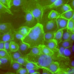 cancer stem cells