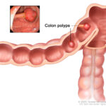 colon_rectal-path