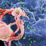 hiv-budding-color