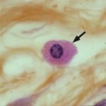 cellula mastocita