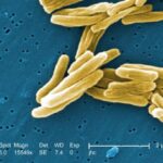 Mycobacterium tuberculosis