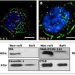 neuroblastome cells