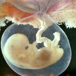 placenta