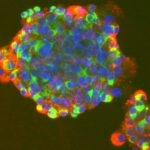 stem_cell1