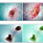 stem_cells