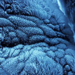 migliaia di minuscole ciglia (qui al microscopio) che tappezzano le pareti delle tube di Falloppio