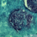 Coccidioides immitis