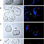 TEL-AML1