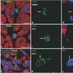 cellule_staminali_cardiache