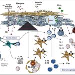 langerhans cells