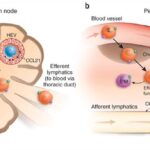 lymph node