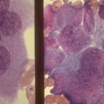 neuroblast_cells