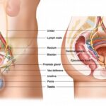 testicle
