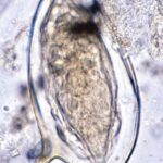 Uova Schistosoma mansoni