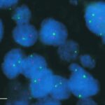 BRCA1 marcato in rosso
