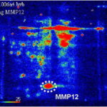 MMP12