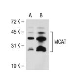 il gene Mcat