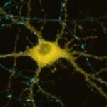 cellula nervosa artificiale