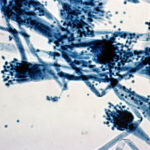 l'Aspergillus fumigatus, che scatena spesso asma e altre reazioni allergiche
