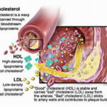 HDL, LDL, diagramma (in inglese)