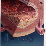 high-cholesterol-in-bloodstream