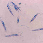 promastigotes-leishmania