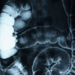 Gastroenterology
