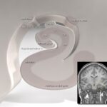 HippocampuS