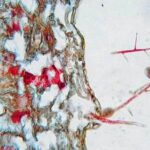 Phytophthora infestans