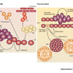 cellule_carcinoma_pancreas