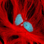 heart_antibodies
