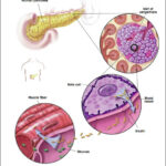 Pancreas e cellule pancreatiche