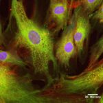 stem-cell_fat_tissue