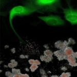 gene-therapy