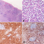 peripheral_T_cells