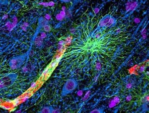 cellule_cerebrali cellule cerebrali 300x227 Sclerosi multipla: quando il sangue al cervello non è sufficiente si scatena la malattia