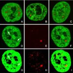immunofluorescenza_linfociti