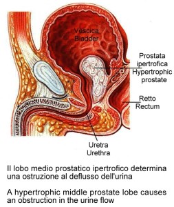 Localizzazione prostata