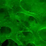 stromal_cells