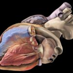 Cardiomyopathy