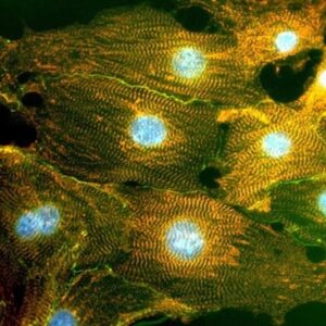 adult stem cells