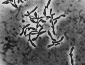 bifidum bifidum 300x230 La mappa genetica dei batteri che provocano carie