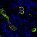 Le cellule staminali mesenchimali del cervello