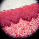 Esophagus_epithelium